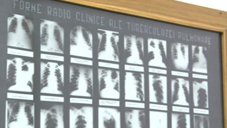 150 de elevi si profesori din Baia Mare, suspecti de TBC Imagine