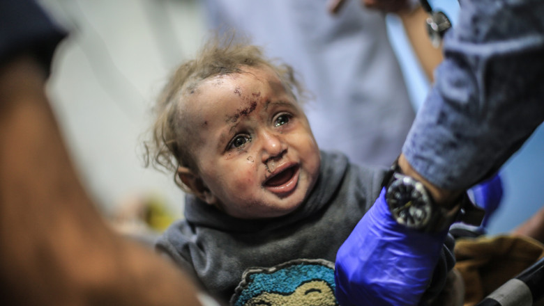 19 copii raniti in Gaza vor fi adusi la spitale din Romania. Cei mai multi vor fi luati din Cisiordania Imagine
