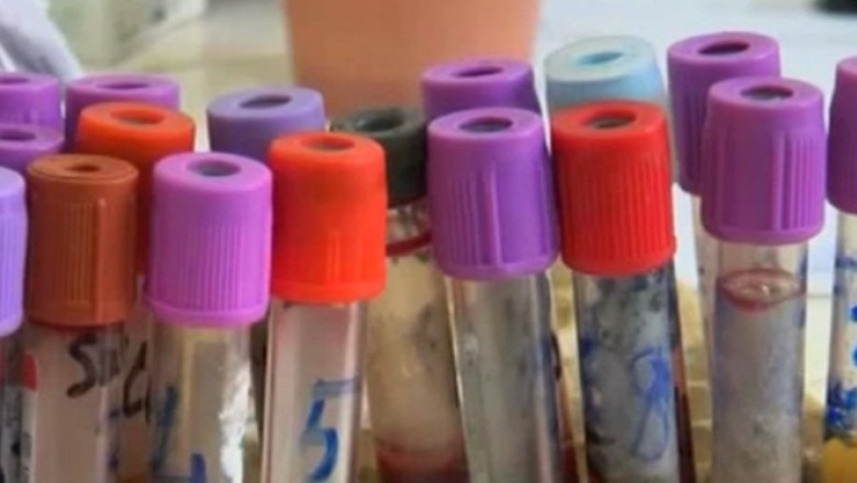 59 de oameni, ucisi de Ebola in Guineea Imagine