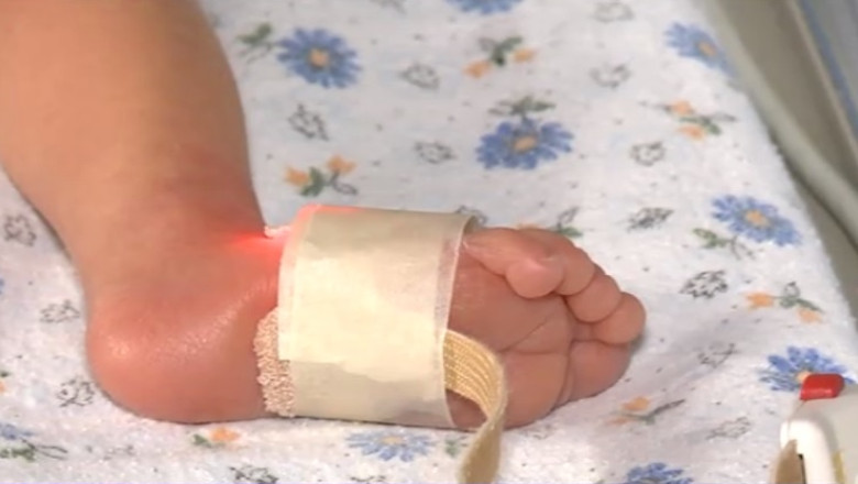 8.000 de copii cu boli genetice, trei centre de diagnostic Imagine