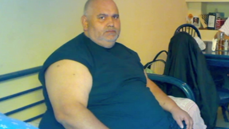 A DOUA VIAtA Un roman a scapat de obezitate dupa o operatie de micsorare a stomacului Imagine