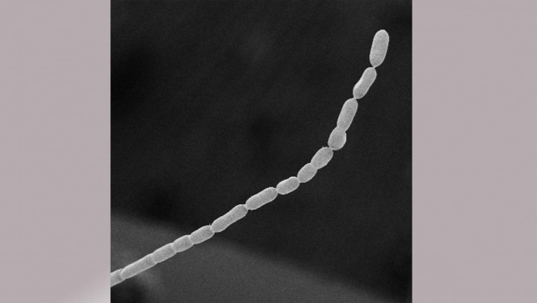 A fost descoperita cea mai mare bacterie din lume. „E ca si cum ai intalni un om inalt cat Muntele Everest” Imagine