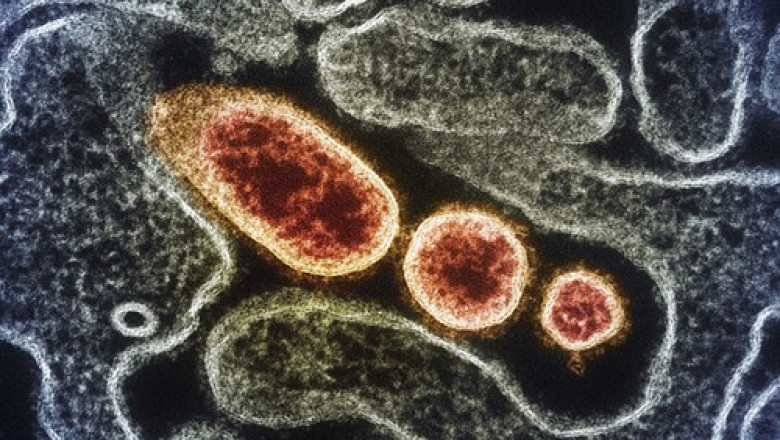 A inceput testarea pe oameni a unui vaccin impotriva Nipah, virusul letal care se transmite de la lilieci Imagine