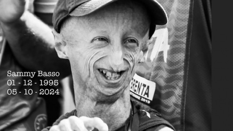 A murit omul de stiinta Sammy Basso, diagnosticat cu progerie, boala pe care o studia. Avea 28 de ani Imagine