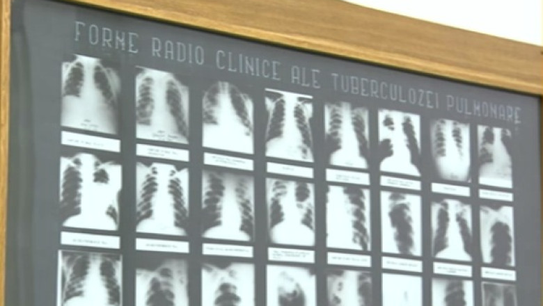 Alerta la Constanta. Profesorul de inot de la Palatul Copiilor, depistat cu TBC Imagine