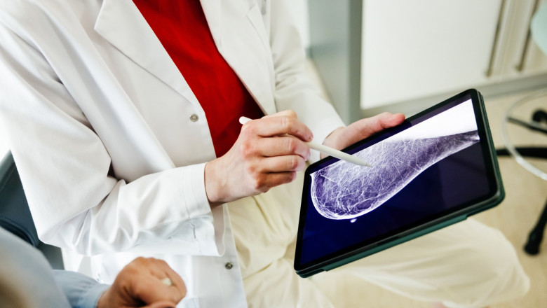 „Am facut chimioterapie si histerectomie totala”. Marturia cutremuratoare a femeii din Constanta, diagnosticata gresit cu cancer Imagine