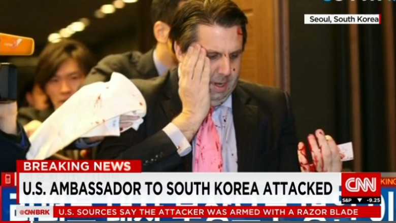 Ambasadorul SUA in Coreea de Sud a fost atacat cu o lama de ras Imagine