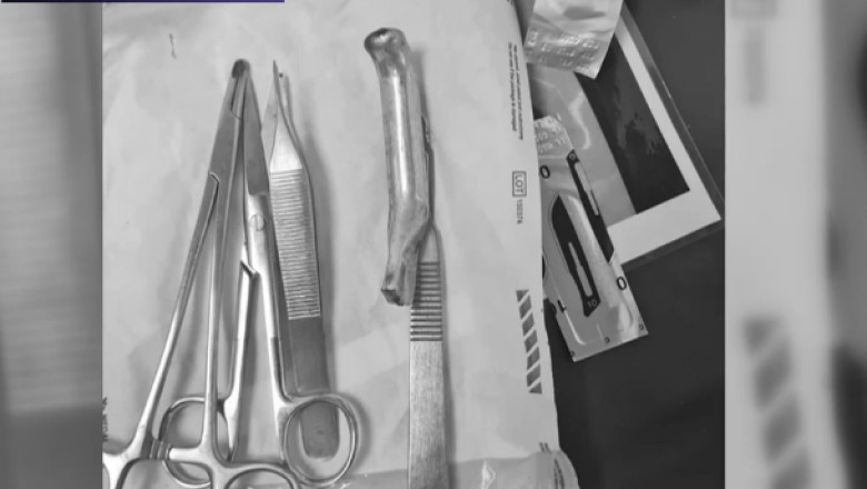 Amenda de 32.000 de lei pentru Spitalul Urlati, unde un medic i-a cusut unui pacient, in picior, manerul de la frana bicicletei Imagine