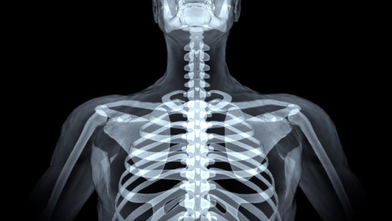 Analize gratuite, doar in teorie. La Oradea, banii alocati pentru o luna de radiografii se termina in 24 de ore Imagine