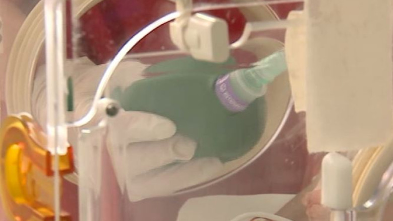 Aparatura rudimentara la Spitalul de Pediatrie din Iasi: copiii cu probleme de respiratie sunt ventilati manual Imagine