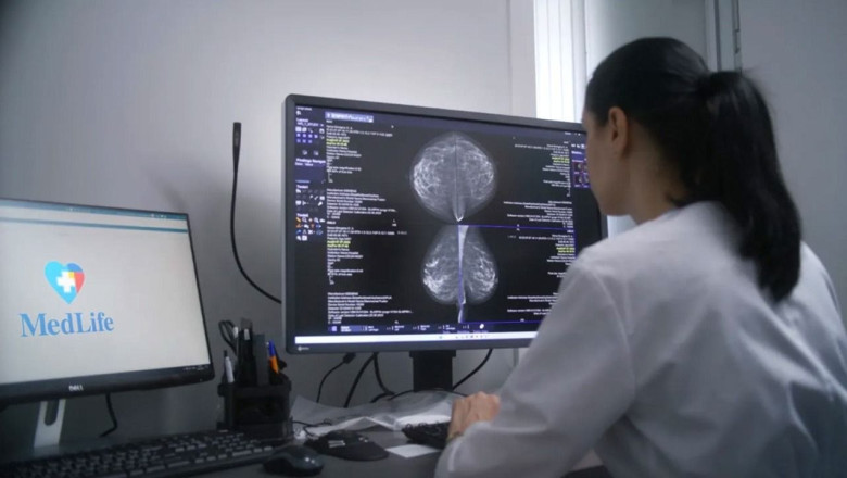 AVC ischemic la doar 35 ani. Malformatia care i-a pus viata in pericol, tratata printr-o procedura minim invaziva