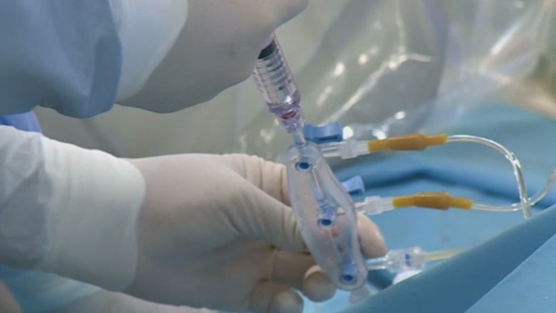 Bani putini, operatii putine Imagine