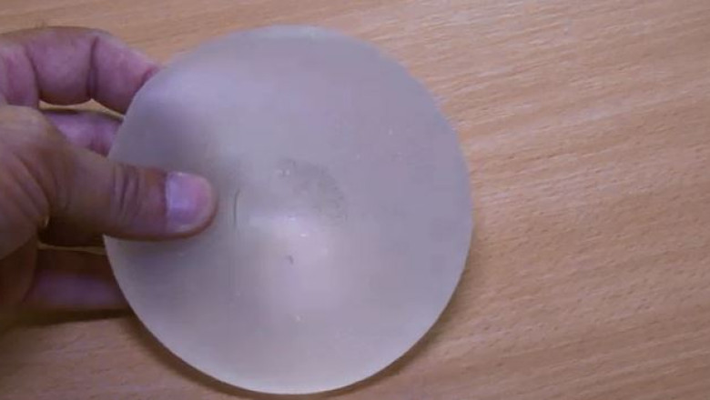 Bani putini pentru reconstructiile mamare Imagine