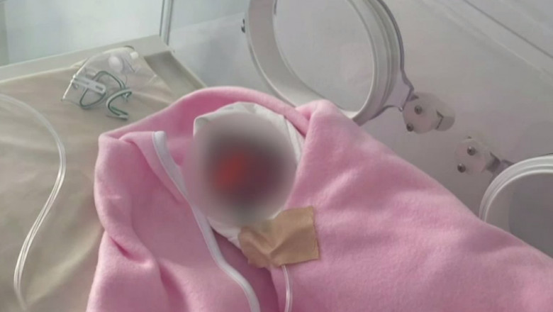 Bebelus de doar 500 de grame si 25 de centimetri lungime, nascut la Harsova. Medicii ii dau sanse pentru ca respira fara aparate Imagine