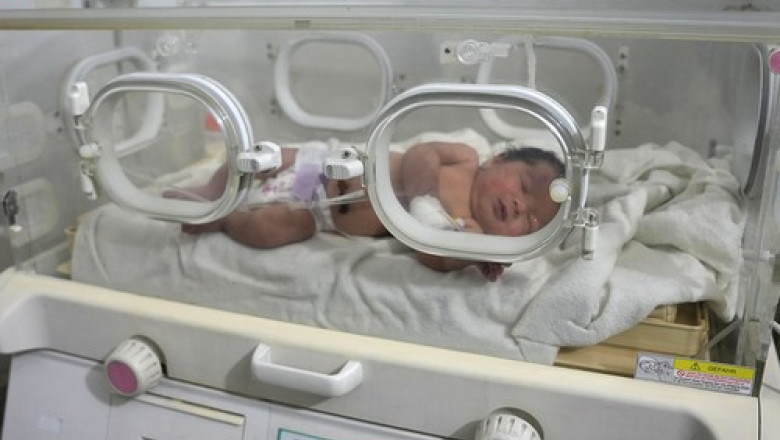 Bebelus nascut sub daramaturi in Siria. A fost gasit cu cordonul ombilical inca atasat de mama care murise Imagine