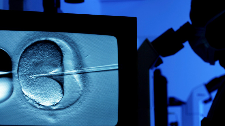 Bebelusii conceputi folosind ADN-ul a trei persoane se nasc fara boli ereditare: tehnica unicat folosita de medicii din Marea Britanie Imagine