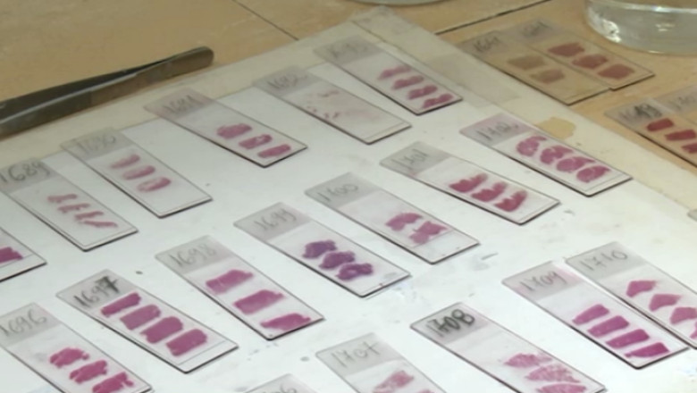 Bolnavii de HIV au ramas fara medicamente: Ministerul Sanatatii nu a trimis suficienti bani spitalelor Imagine