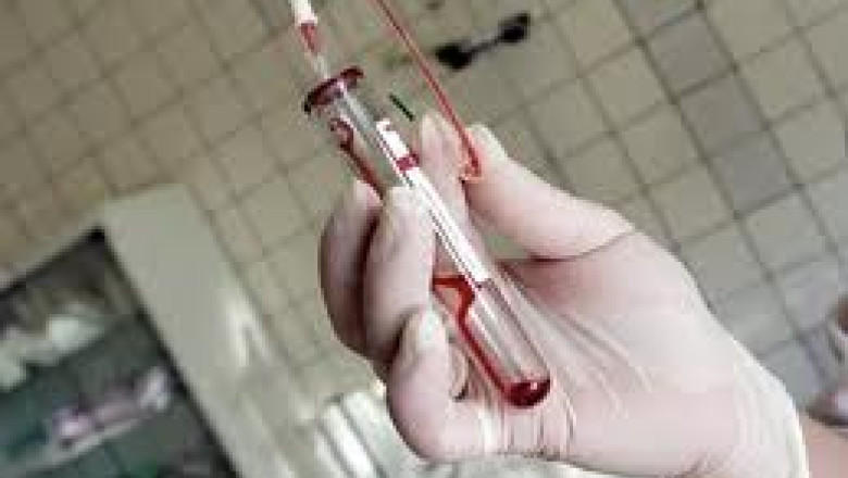 Bonavii de HIV/SIDA, fara medicamente. Aproape 900 de constanteni isi cer dreptul la viata Imagine