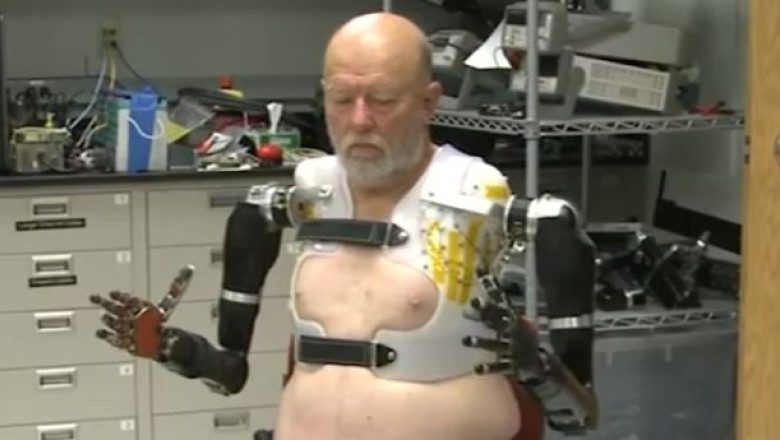 Brate robotice miscate cu puterea gandului. Cercetatorii din SUA au redat speranta unui barbat cu mainile amputate Imagine