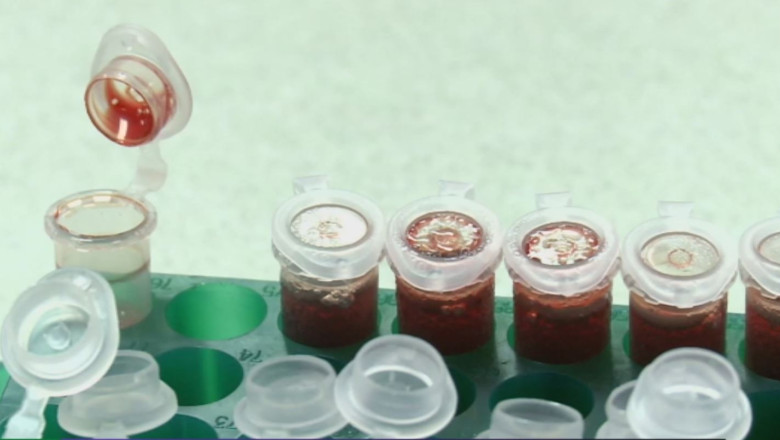 Brevet pentru reteta sangelui artificial Imagine