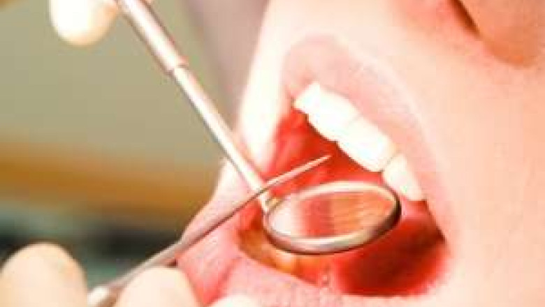 Camera ascunsa. Doar 29 de dentisti au incheiat contract cu Casa de Asigurari. Tratamentul gratuit, greu de obtinut Imagine
