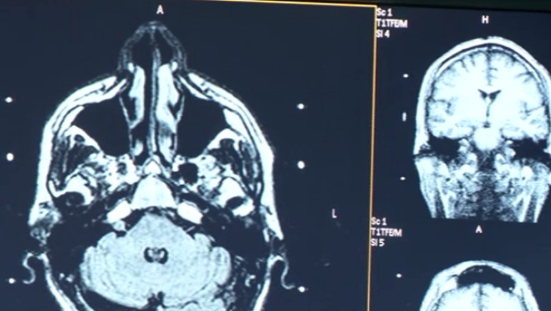 CAMERA ASCUNSA. „Taxa de monitorizare” pentru pacientii naivi Imagine