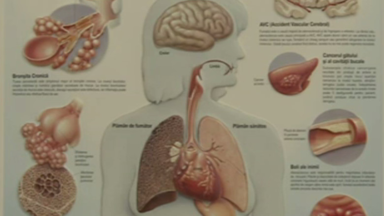 Campanie nationala de testari gratuite pentru plamani Imagine