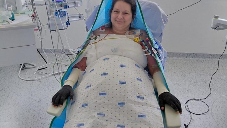 Care este starea Laviniei, pacienta cu arsuri infectata la Floreasca si transferata in Belgia. Anuntul surorii sale: „Ramane un mister” Imagine