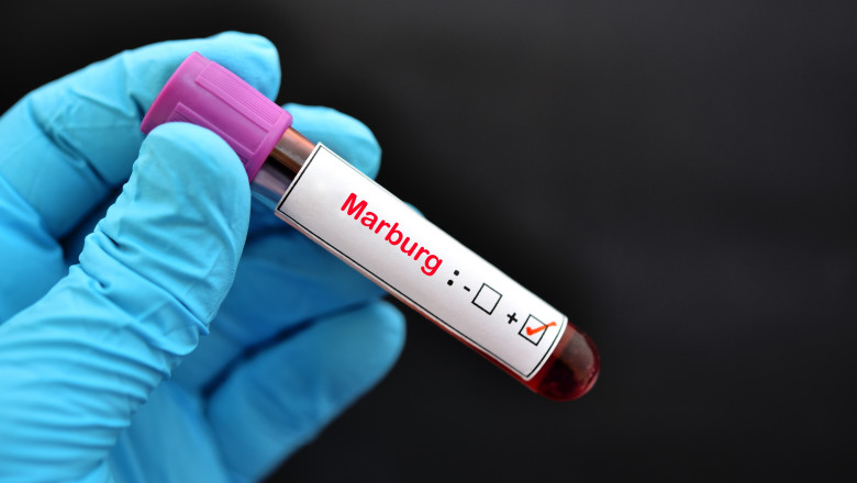 Cat de periculos este virusul Marburg, comparat cu boala Ebola. Ce spune medicul infectionist despre o posibila infectare si in Romania Imagine