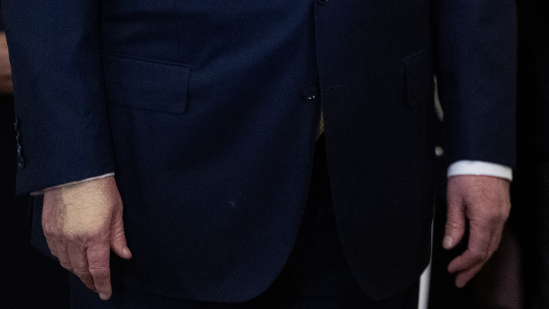 Ce este insuficienta venoasa cronica, boala de care sufera Donald Trump. Medic: „Ridica un semnal de alarma despre problemele de fond” Imagine