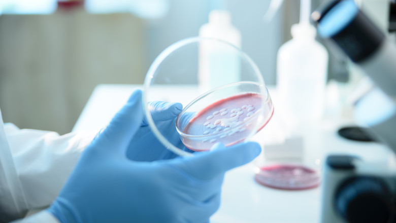 Ce este Serratia marcescens, bacteria descoperita la Spitalul „Sfanta Maria” din Iasi, unde au murit sase copii Imagine