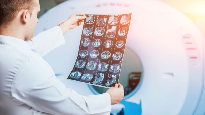 Centrele de imagistica REGINA MARIA: O radiografie a investigatiilor efectuate de romani in 2022 Imagine