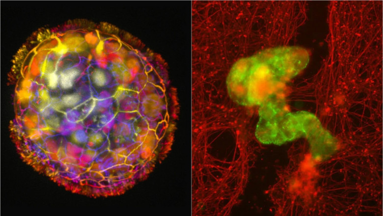 Cercetatorii au creat „roboti vii” din celule umane cu care au reusit sa vindece neuroni Imagine