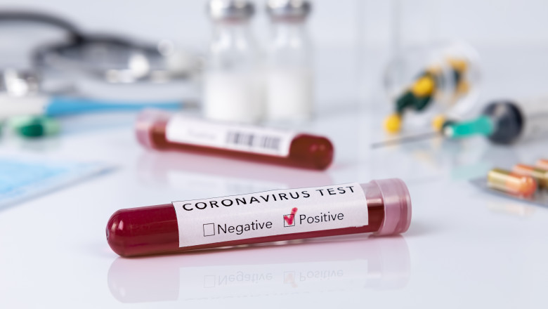 CIA: Este „mai probabil” ca pandemia de COVID-19 a provenit dintr-un laborator si nu din natura Imagine