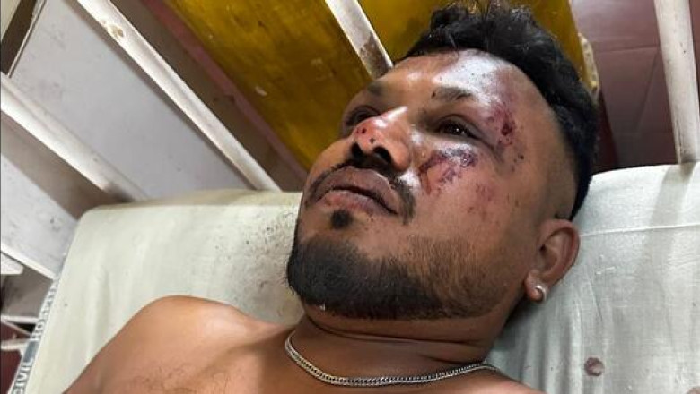Cine este supravietuitorul accidentului aviatic din India: „Cand m-am ridicat, erau cadavre in jurul meu. Mi-a fost frica” Imagine