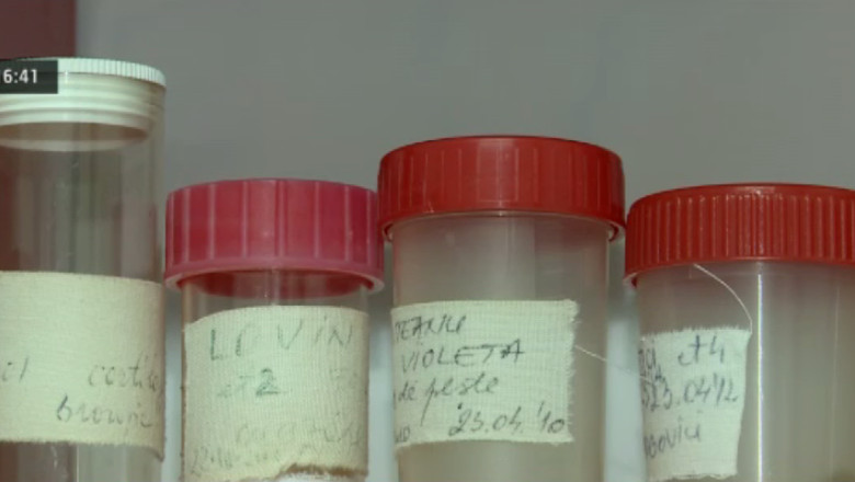 Colectie inedita la Spitalul de Pneumoftiziologie din Iasi Imagine