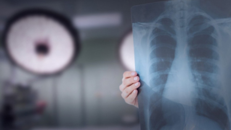 Colegiul Medicilor, despre legea malpraxisului: ”Ministerul Sanatatii nu a reusit sa realizeze o propunere alternativa” Imagine