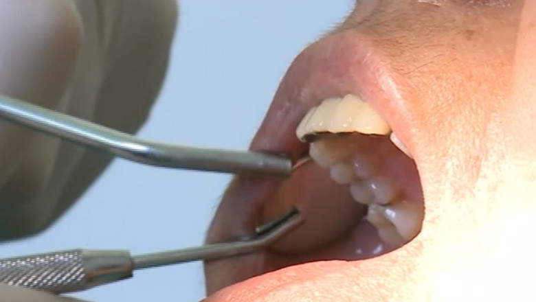 Consultatii stomatologice gratuite pana la sfarsitul anului Imagine