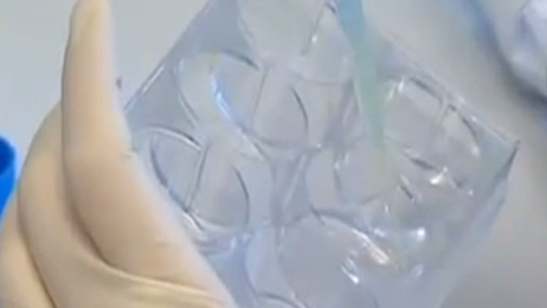 Contraceptivul pentru barbati este la un pas de a fi pus la punct Imagine