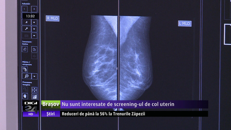 COVASNA. Nu sunt interesate de screening-ul de col uterin  Imagine