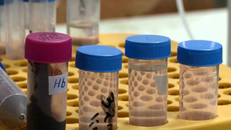 Crowdfunding pentru sangele artificial Imagine