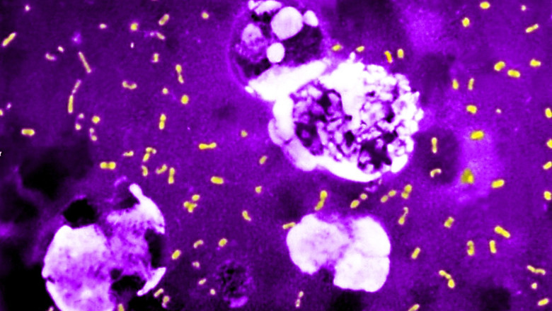 Cum a evoluat cea mai letala bacterie din toate timpurile ca sa continue sa omoare milioane de oameni si sa supravietuiasca pana astazi Imagine