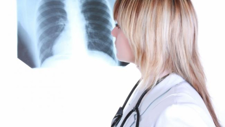 Cum deosebim pneumonia de raceala - medic Imagine