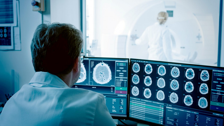 Cum recunoastem un accident vascular cerebral si cum reactionam Imagine