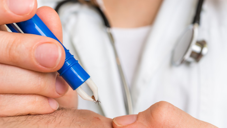 Cum scoti corect o capusa si cand trebuie sa mergi la medic. Avertismentul specialistilor: „Nu se folosesc substante pe piele” Imagine