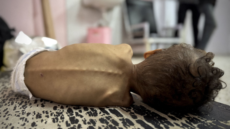 „Daca bebelusul ar putea vorbi, ar tipa, intrebandu-ne ce ii punem in stomac”. Nou-nascutii din Fasia Gaza, hraniti cu ierburi si ceai Imagine