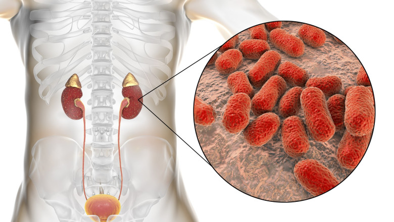Descoperire medicala importanta: A fost creat un nou antibiotic care poate ucide superbacteria Acinetobacter Imagine