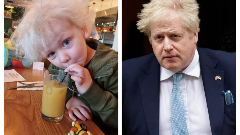 Din cauza Sindromului „Parului de Nepieptanat”, un baietel de 3 ani seamana izbitor de mult cu premierul britanic Boris Johnson Imagine