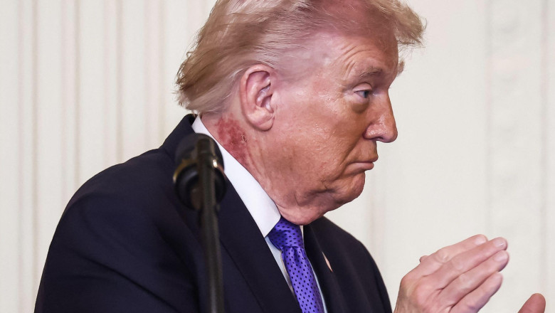 Donald Trump a fost supus celui de-al treilea control medical in 13 luni: ce a declarat presedintele SUA care face 80 de ani in iunie