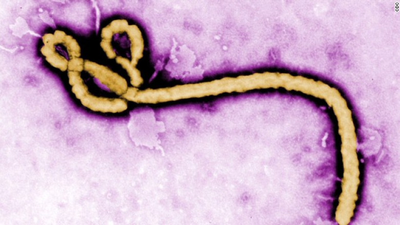 Doua cazuri suspecte de Ebola in Marea Britanie Imagine